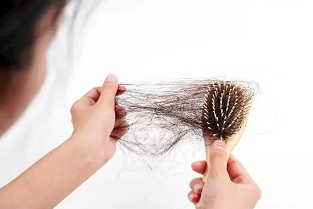 Hair Loss Treatment for Women