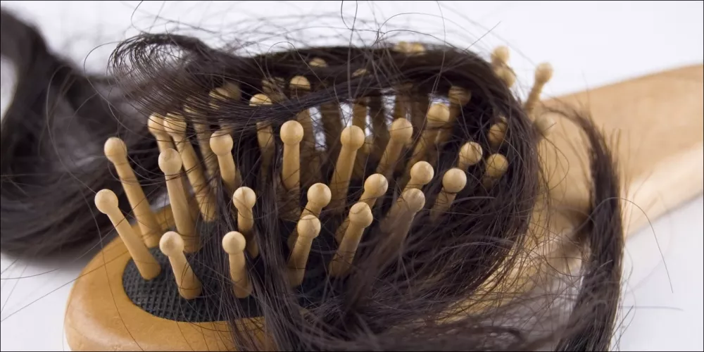 علاج تساقط الشعر للنساء