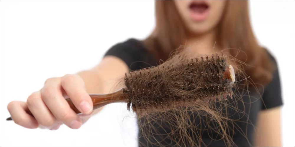 Hair Loss Treatment for Men and Women The Practical Medical Guide 2026 3 Hair Loss Treatment